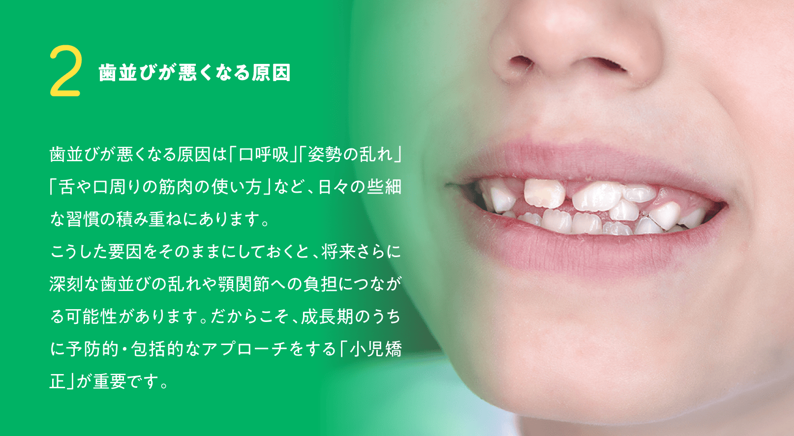 2. 歯並びが悪くなる原因