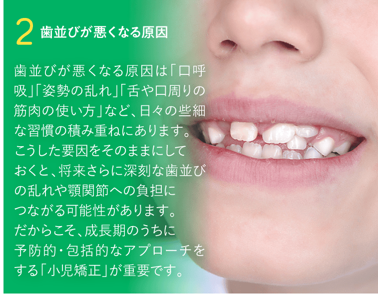 2. 歯並びが悪くなる原因