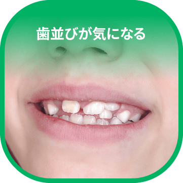 歯並びが気になる