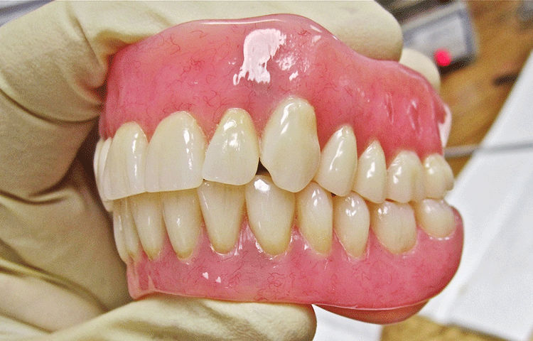 入れ歯の構造について