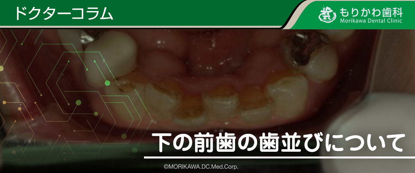 八尾市　歯医者　下の前歯の歯並びについて