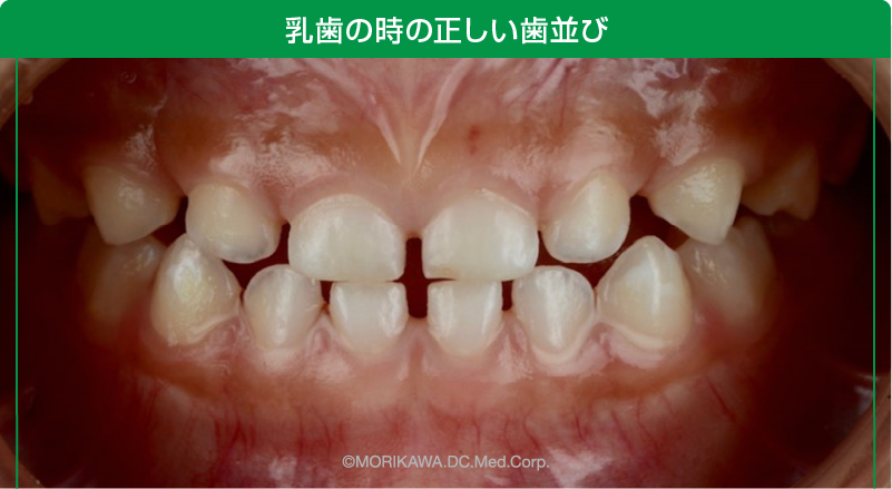 乳歯の時の正しい歯並び