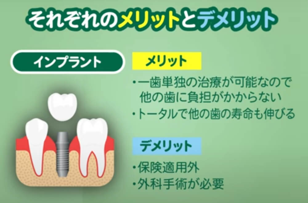 歯の欠損の対処法その3【インプラント】