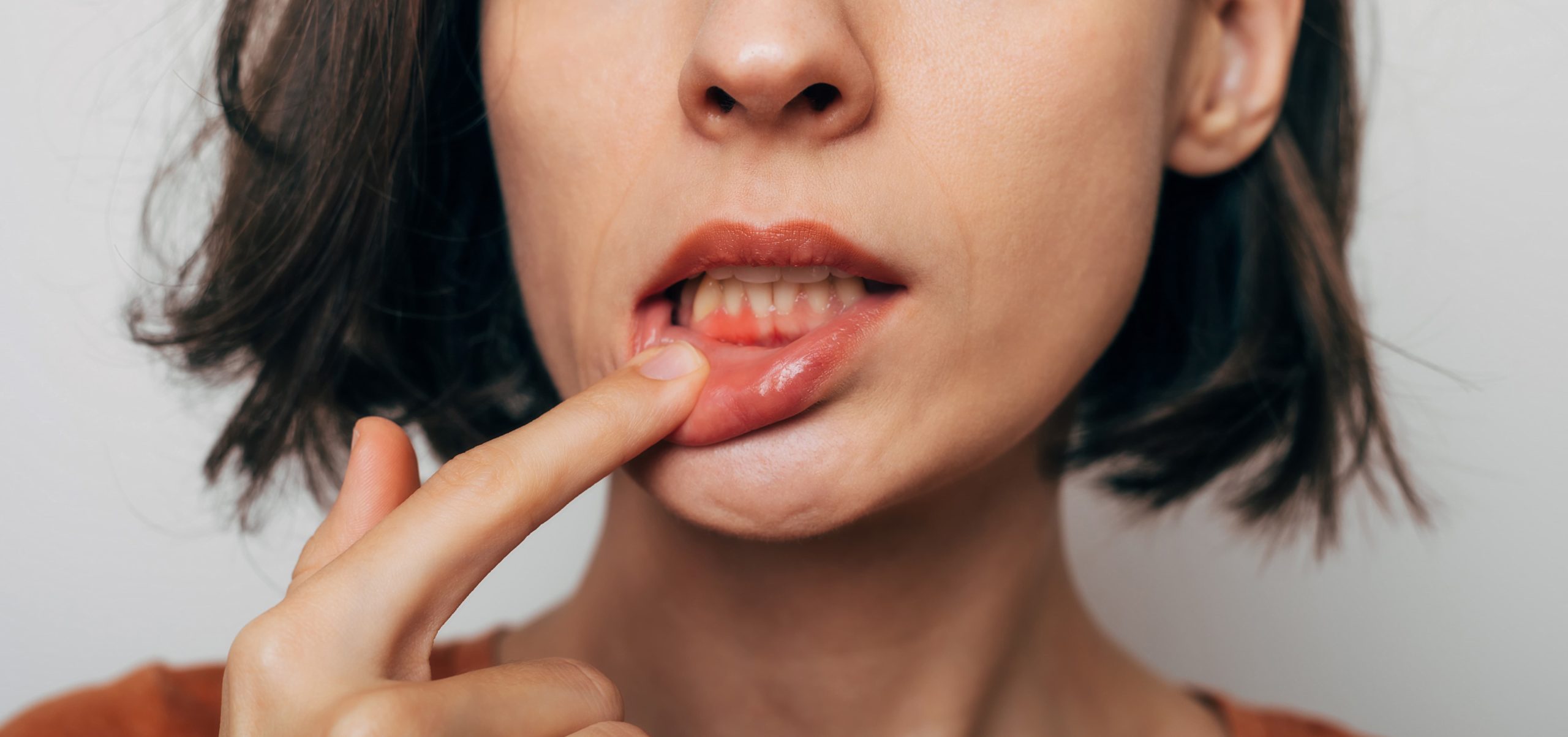 periodontal-disease-risk-