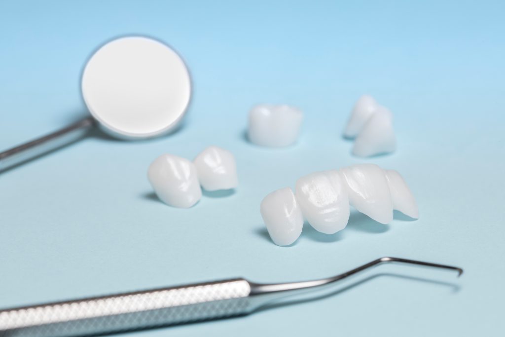 セラミックの歯と治療器具