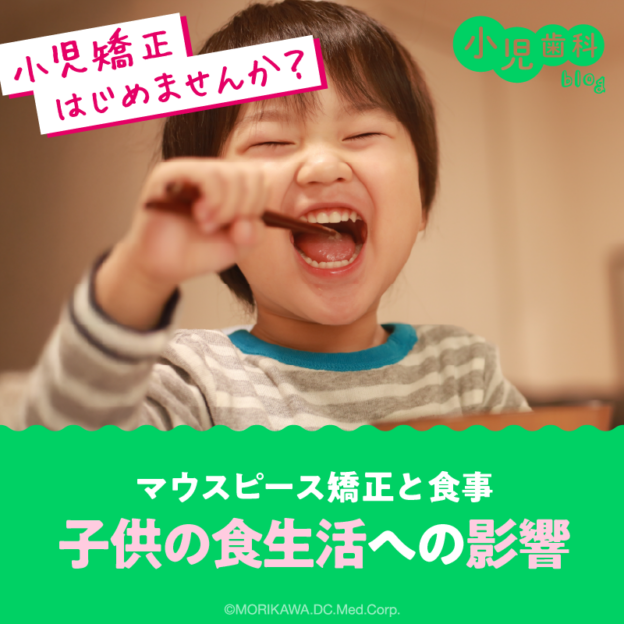マウスピース矯正と食事：子供の食生活への影響