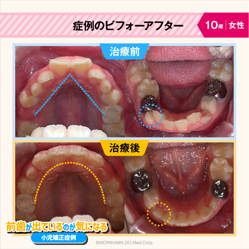 症例のビフォーアフター