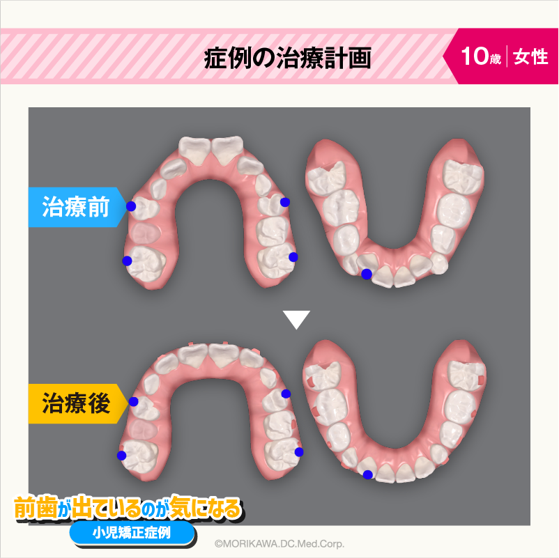 症例の治療計画