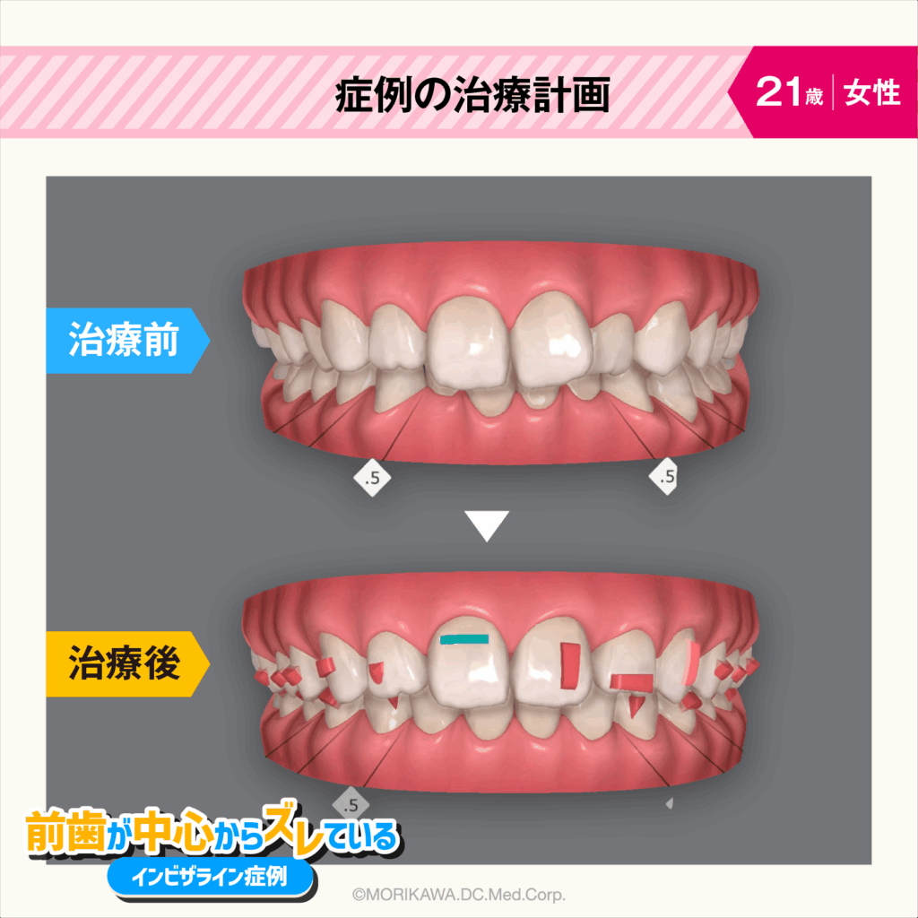 症例の治療計画