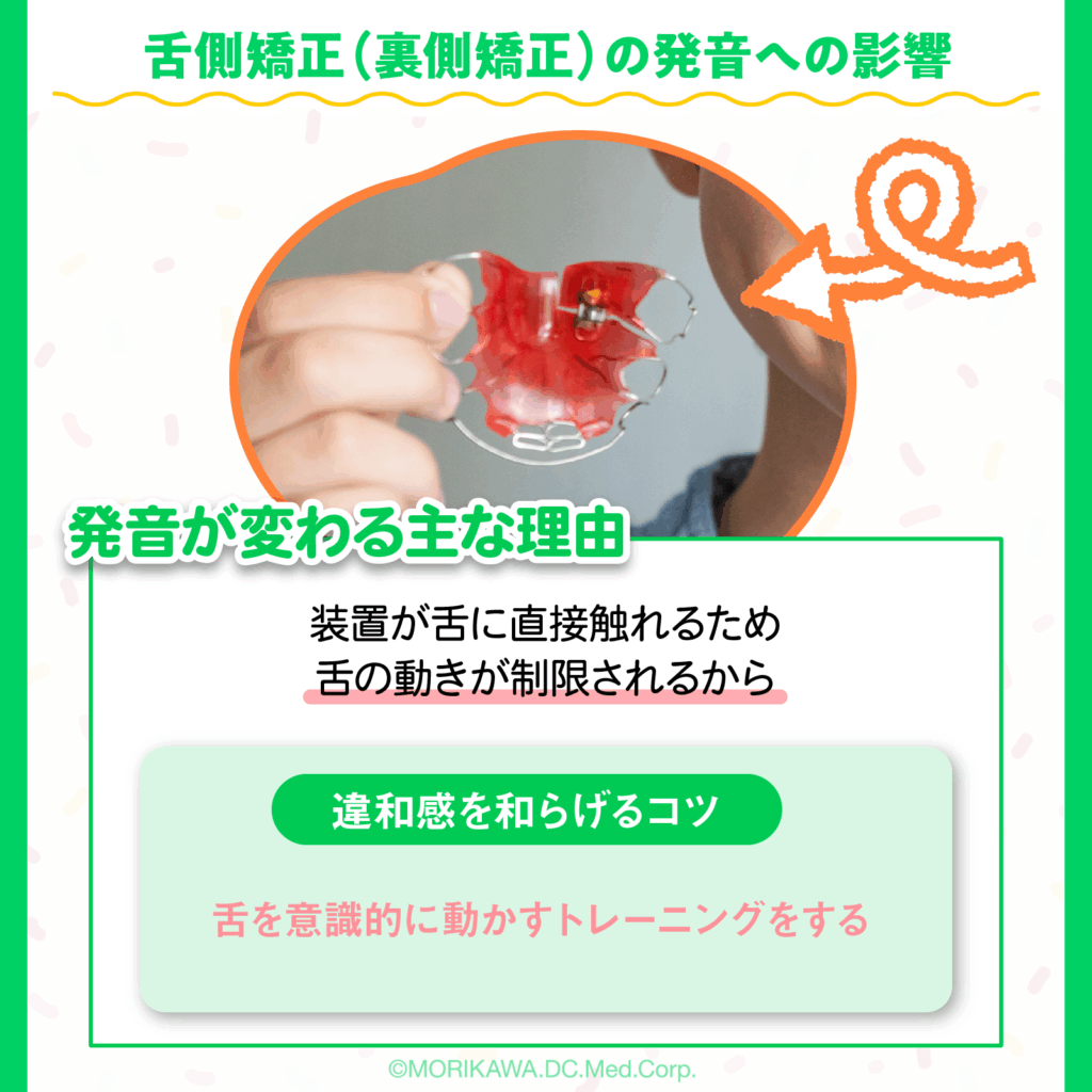 舌側矯正（裏側矯正）の発音への影響