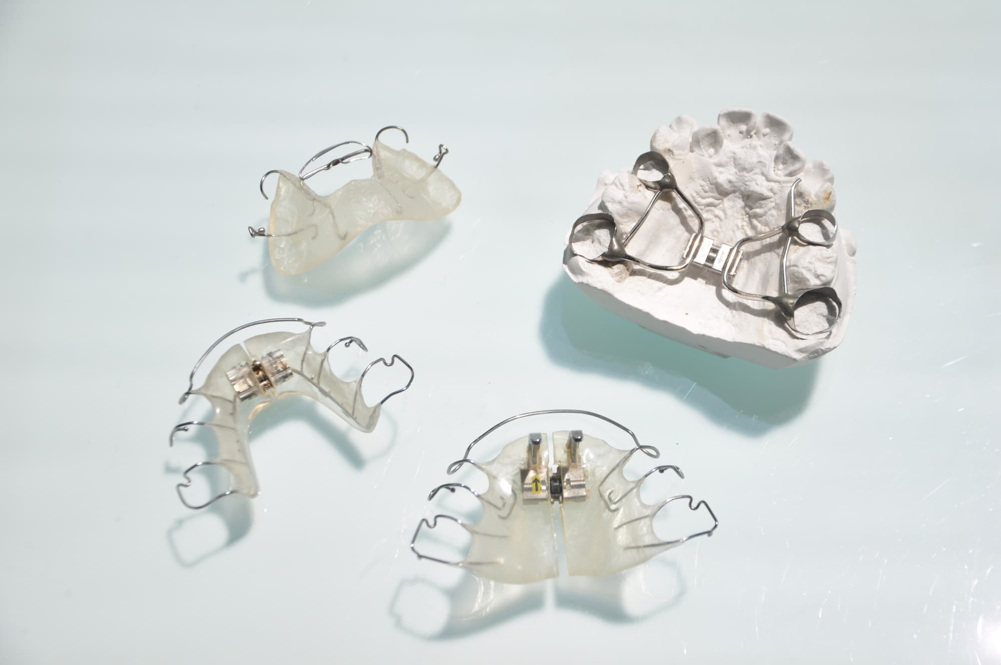 出っ歯の治療に使用する床矯正の装置と急速拡大装置