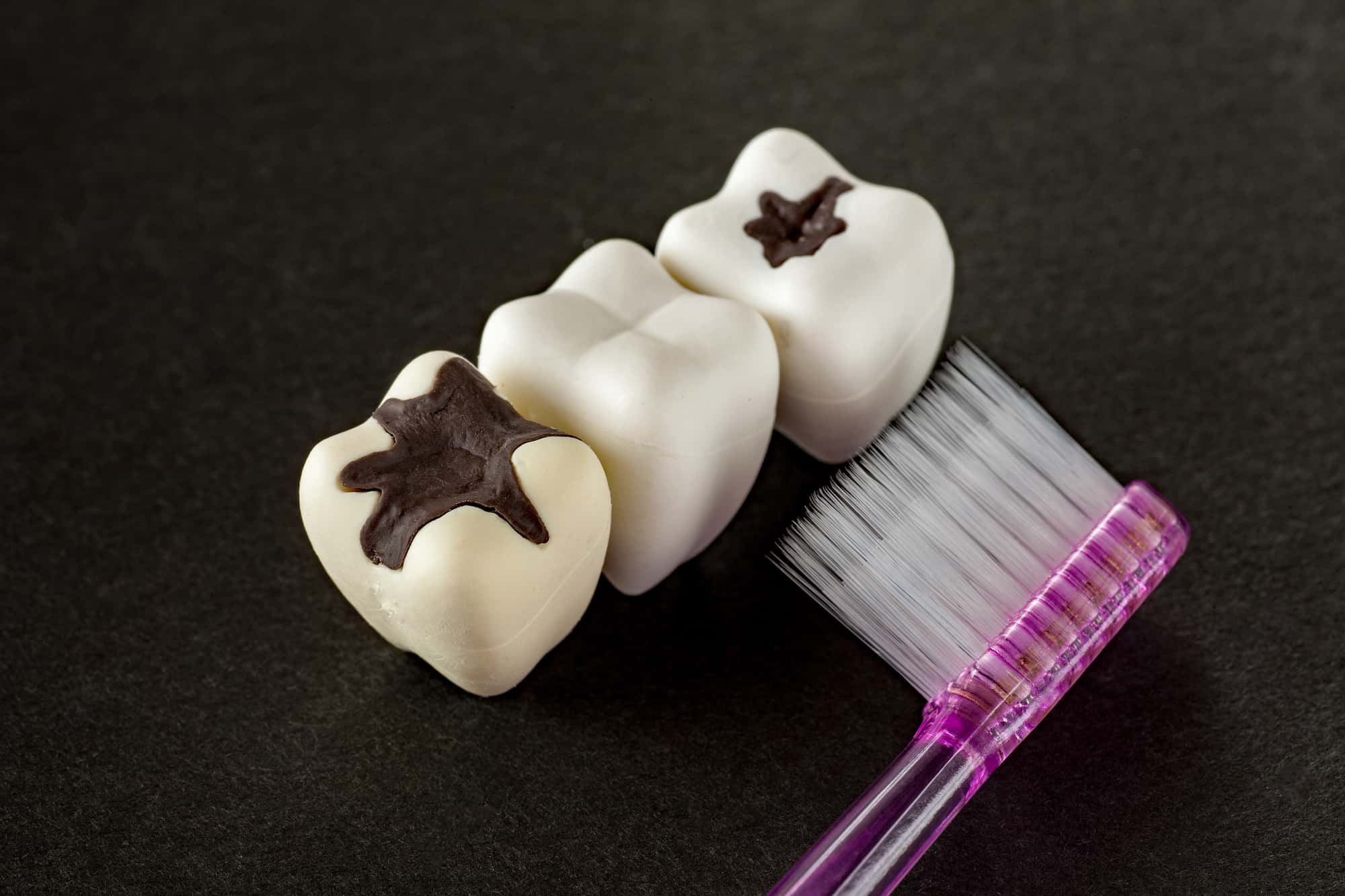 磨き残しで奥歯が虫歯になったイメージ