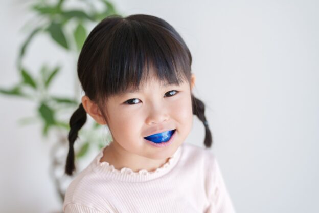 マイオブレースで受け口矯正治療をしている子ども